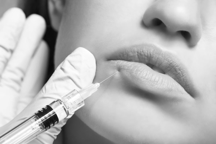 Dermal Fillers Image