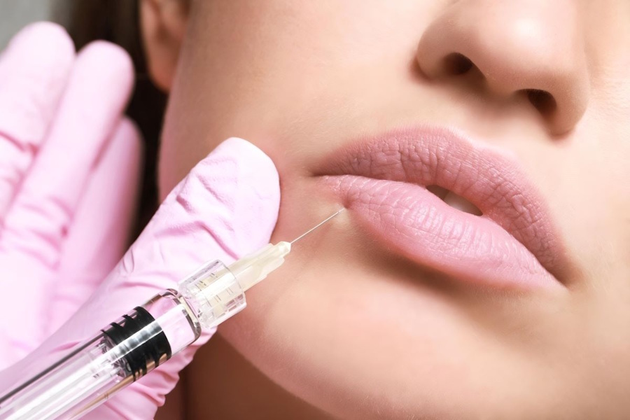 Dermal Fillers Image