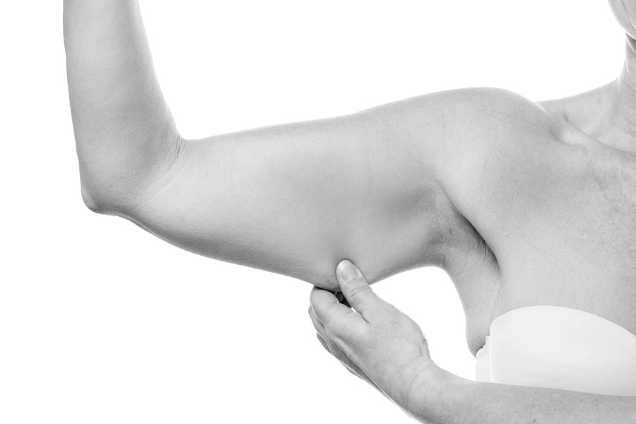 Arm Image