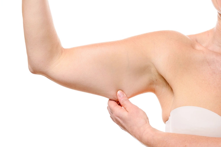 Arm Image