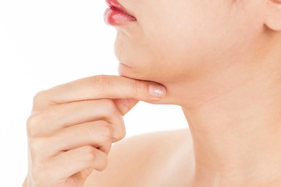 Chin Image