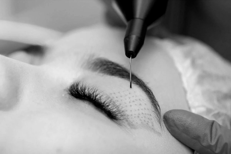 Eyelid Lift Image