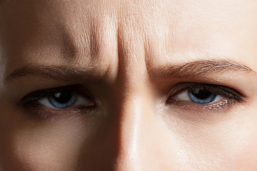 Eyebrow Lift Image