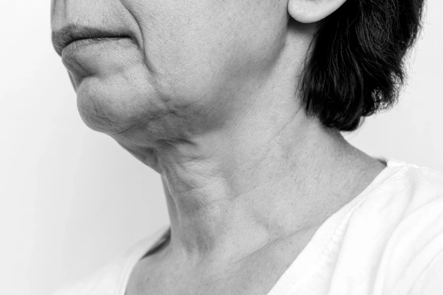 Lower Face Image