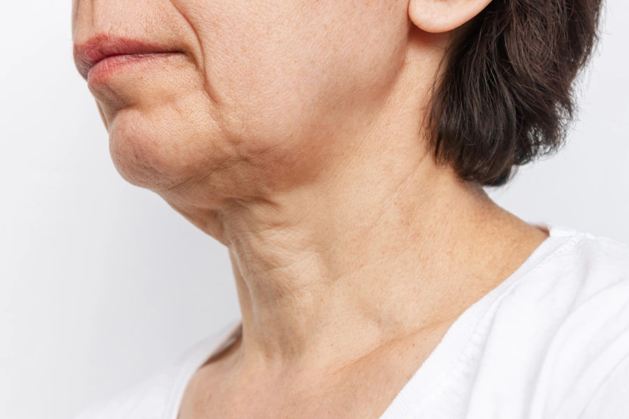 Lower Face Image