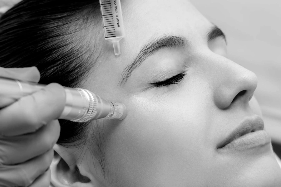 Microneedling Image