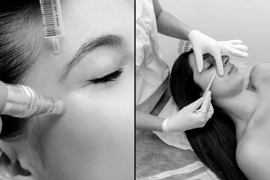Microneedling & Dermaplaning Image