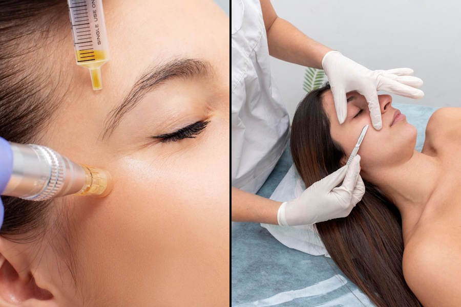 Microneedling & Dermaplaning Image