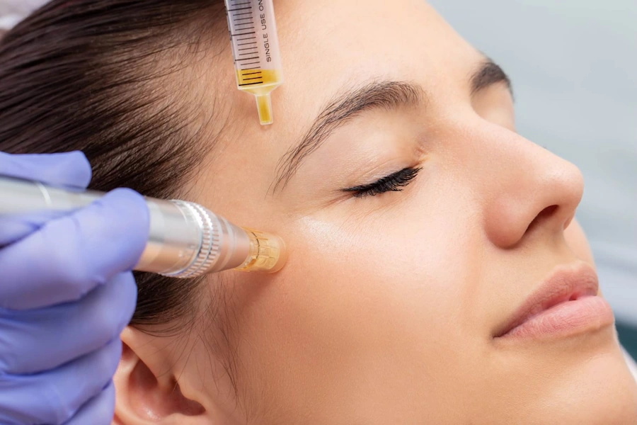 Microneedling Image