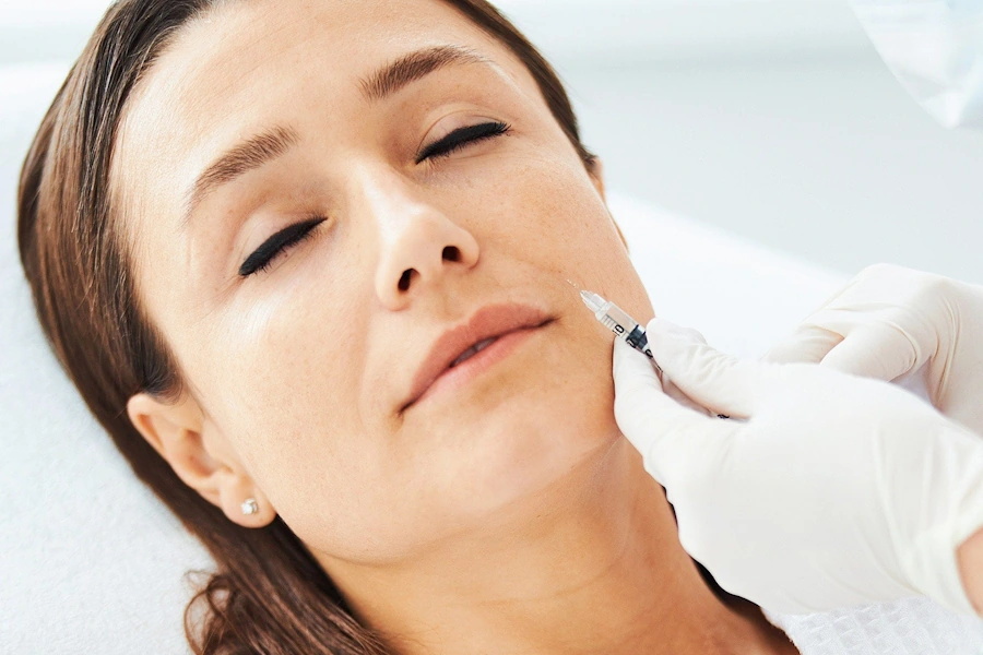 Nasolabial Folds Filler Image